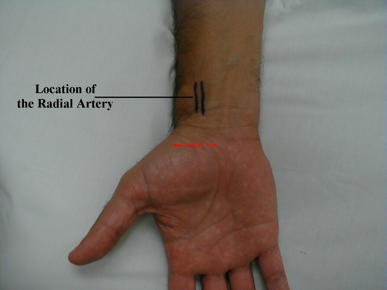 normal radial anatomy